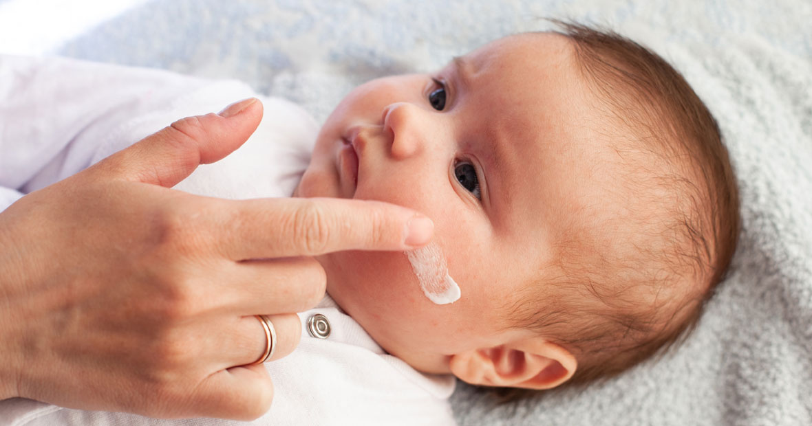 Crème eczéma bébé